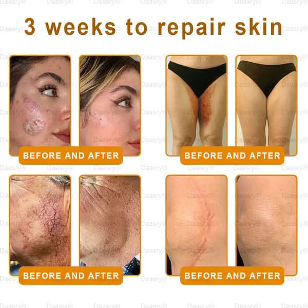 Daasry® “Dermal Gold” Botox Bee Venom Skin Restoration Cream