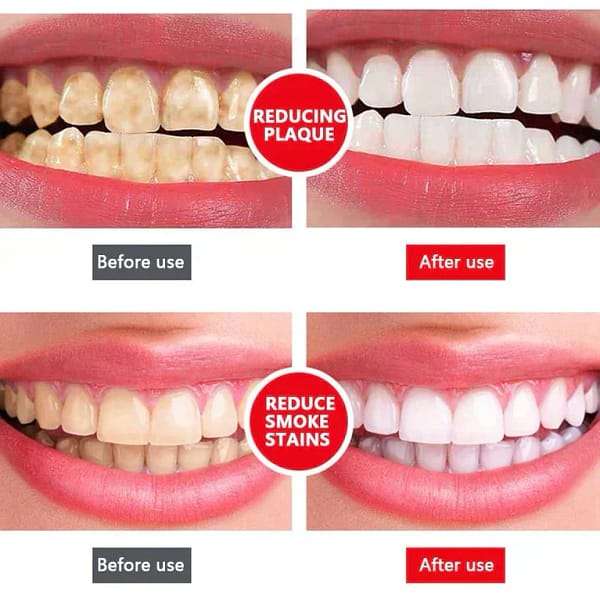 LOVILDS™ Probiotic Whitening Toothpaste