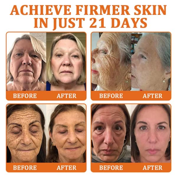 Flysmus Botox Bee Venom Treatment Serum Stick