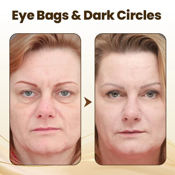 LOVILDS™ Collagen Wake Up Eye Cream
