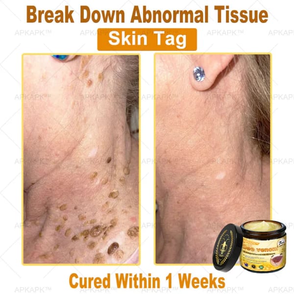 APKAPK™ Bee Venom Skin Treatment Cream