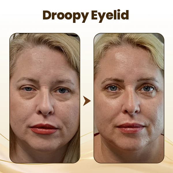 LOVILDS™ Collagen Wake Up Eye Cream