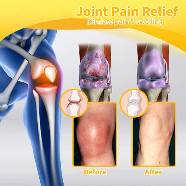 LOVILDSTM Bee Poison Advanced Joint and Bone Therapy Cream