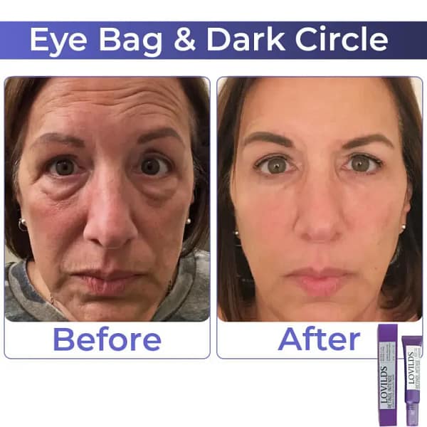 LOVILDS Retinol Intense Advanced Triple Action Eye Cream