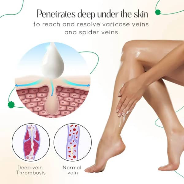 LOVILDS™ Vein Therapy Cream