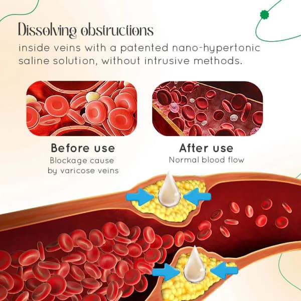 LOVILDS™ Vein Therapy Cream