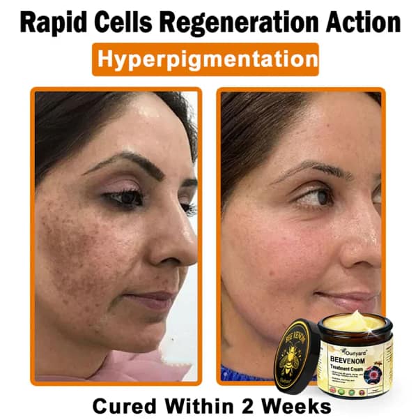 Ourlyard® Botulinum Toxin & Bee Venom Skin Treatment Cream