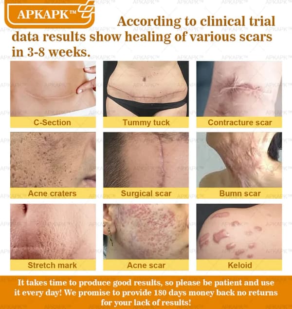 APKAPK™ Bee Venom Skin Treatment Cream