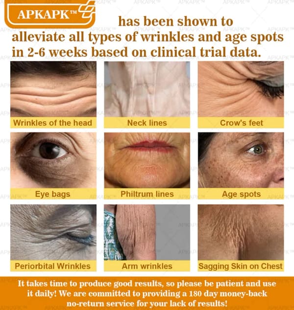 APKAPK™ Bee Venom Skin Treatment Cream