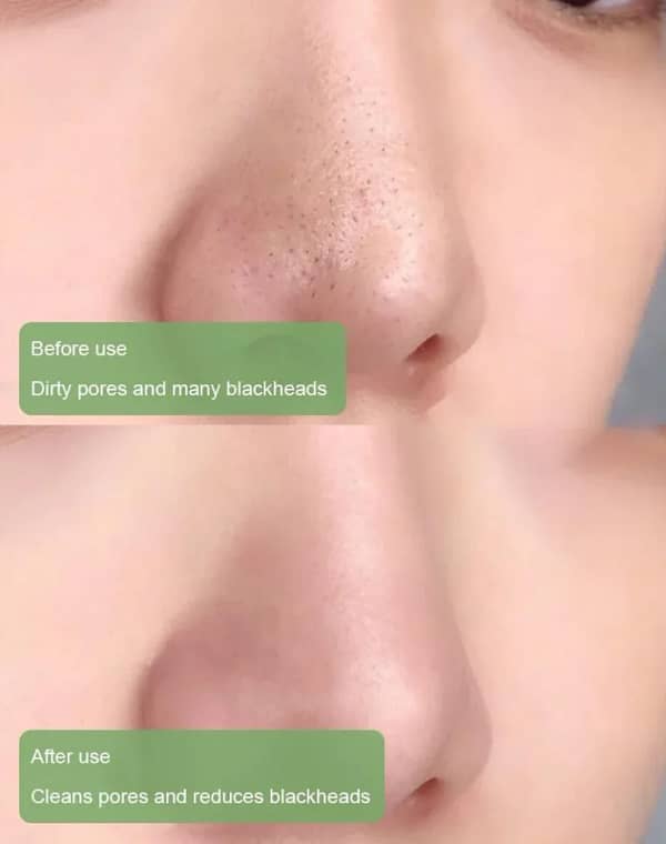 LOVILDS™ Purifying and Antibacterial Green Tea Mask