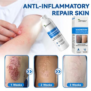 ATTDX® Magnesium Herbal Soothing Spray