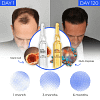 Regrow your hair in 120 days with STEM Cell Complete Hair Cycle Solution 2.0 or your money back