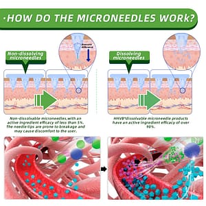 HHVB  Nano Microneedle Patch with SMGT-GLP-1
