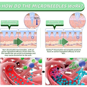 LOVILDS™ SMGT-GLP-1 Nano Microneedle Patch