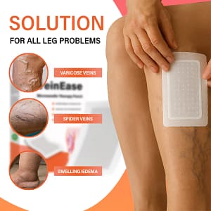 Oveallgo® VeinEase Microneedle Therapy Patch