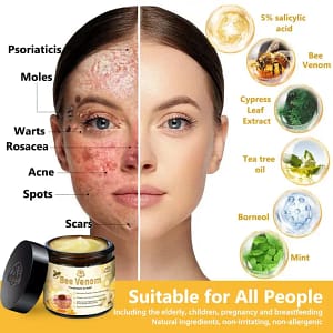 Turonu™ Bee Venom Treatment Cream