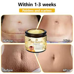 Turonu™ Bee Venom Treatment Cream