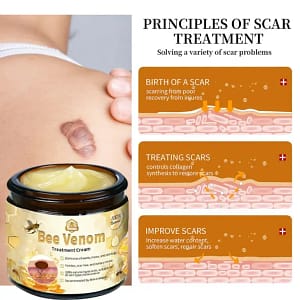 Turonu™ Bee Venom Treatment Cream