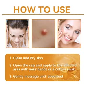 Turonu™ Bee Venom Treatment Cream