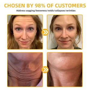 Fivfivgo™ BeeLift Anti-Ageing Firming Cream