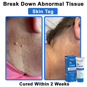 Ourlyard® OatCalm Skin Repair Cream