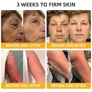 Fivfivgo™ BeeLift Anti-Ageing Firming Cream