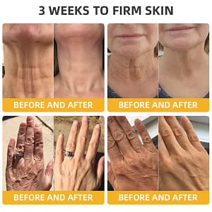 Fivfivgo™ BeeLift Anti-Ageing Firming Cream