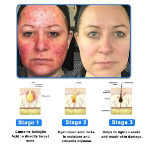 Ourlyard® OatCalm Skin Repair Cream