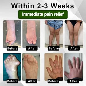 Fivfivgo™ Emu Oil JointRelief Ointment
