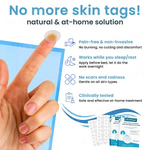 Fivfivgo® Nano-Micro Needle Skin Tags Removal Patches