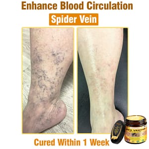 LOVILDS™ Bee Venom All-in-One Cream