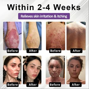 Fivfivgo® Purple Corn Multi-Condition Skin Spray