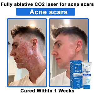 Ourlyard® OatCalm Skin Repair Cream