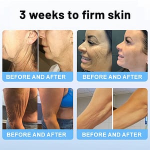 TLOPA® Botox Bee Venom Firming Serum Stick