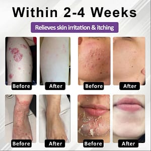 Fivfivgo® Purple Corn Multi-Condition Skin Spray