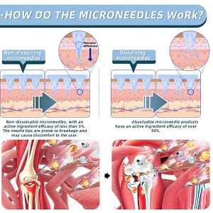 Fivfivgo® Nano-Microneedle Joint Patch