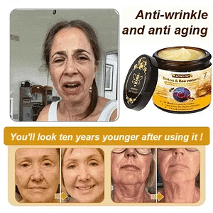 ADNOON™ Botox & Bee Venom Skin Treatment Cream