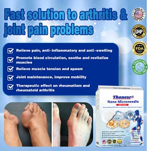 Thonesr® Nano-microneedle joint patch