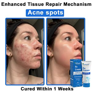 Ourlyard® OatCalm Skin Repair Cream