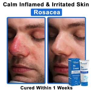 Ourlyard® OatCalm Skin Repair Cream