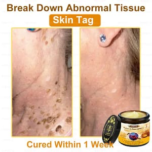 ADNOON™ Botox & Bee Venom Skin Treatment Cream