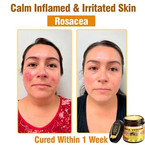 LOVILDS™ Bee Venom All-in-One Cream