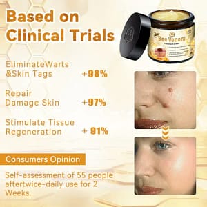 Turonu™ Bee Venom Treatment Cream