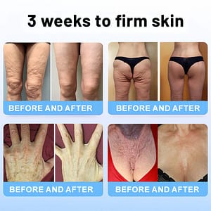 TLOPA® Botox Bee Venom Firming Serum Stick