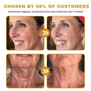 ADNOON™ Botox & Bee Venom Skin Treatment Cream