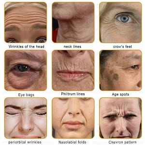ADNOON™ Botox & Bee Venom Skin Treatment Cream