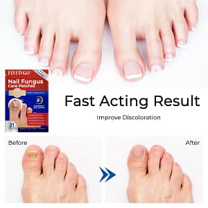 Fivfivgo® Nail Fungus Care Patches