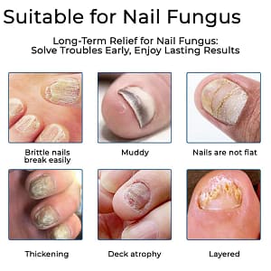 Fivfivgo® Nail Fungus Care Patches