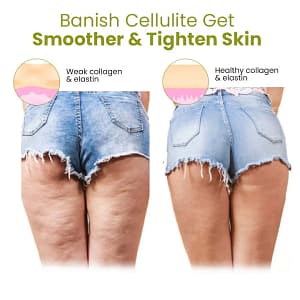 Fivfivgo™ HerbalFirm Cellulite Reduction Patches