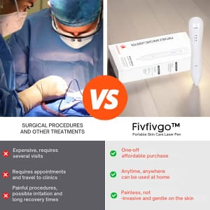 Fivfivgo™ Portable Skin Care Laser Pen